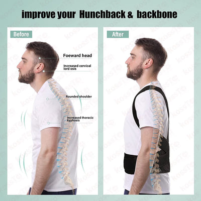 Adjustable Posture Corrector Belt – Breathable Back Support Brace